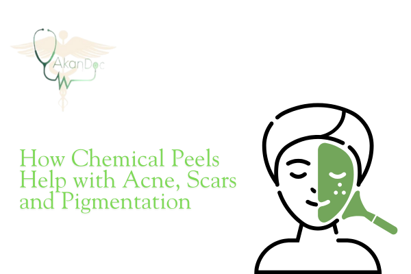 Chemical Peels Services